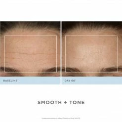 NuFACE Trinity Pro Facial Toning Kit + ELE