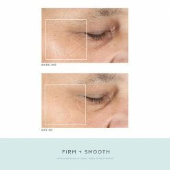 NuFACE Trinity Pro Facial Toning Kit + ELE