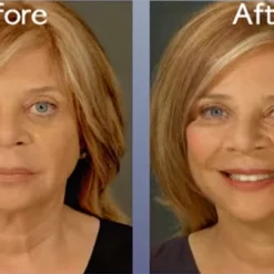 Skincare Art Harding Instant Face And Neck Lift