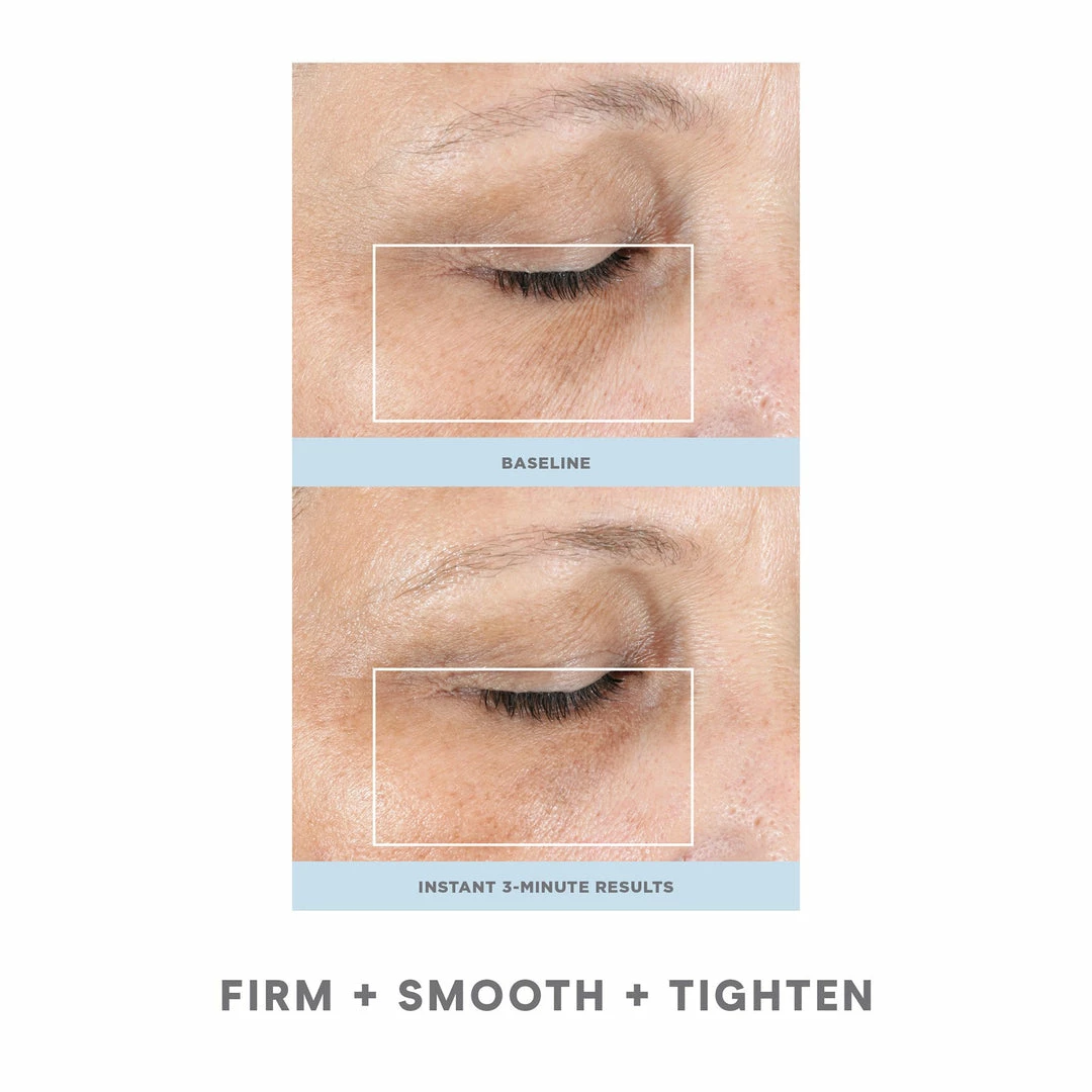 NuFACE FIX 3 NuFACE FIX