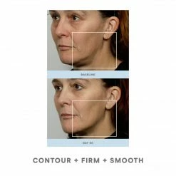 NuFACE Trinity Pro Facial Toning Kit + ELE