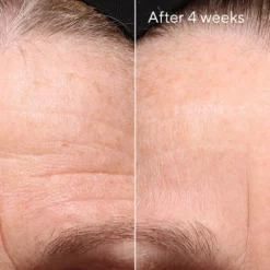 Murad Retinol Youth Renewal Night Cream 5 Murad Retinol Youth Renewal Night Cream