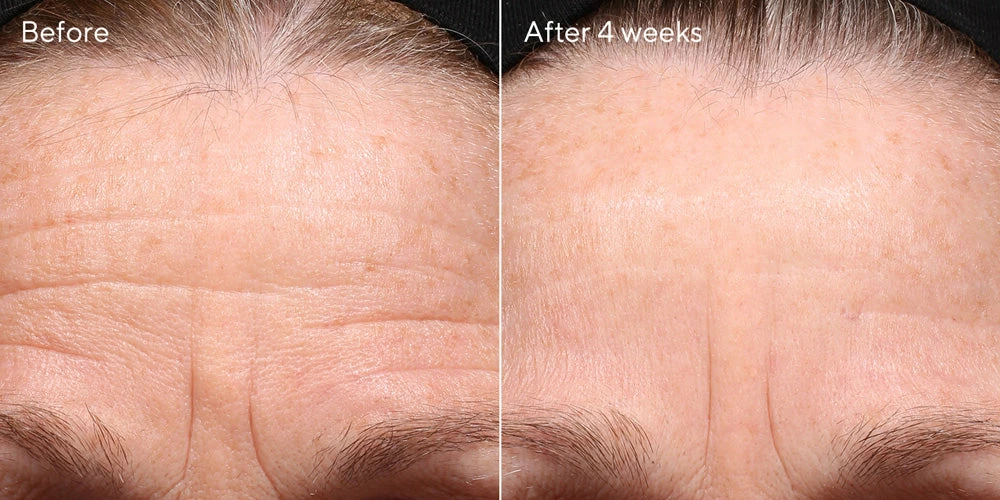 Murad Retinol Youth Renewal Night Cream 3 Murad Retinol Youth Renewal Night Cream