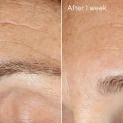 Murad Replenishing Multi-Acid Peel