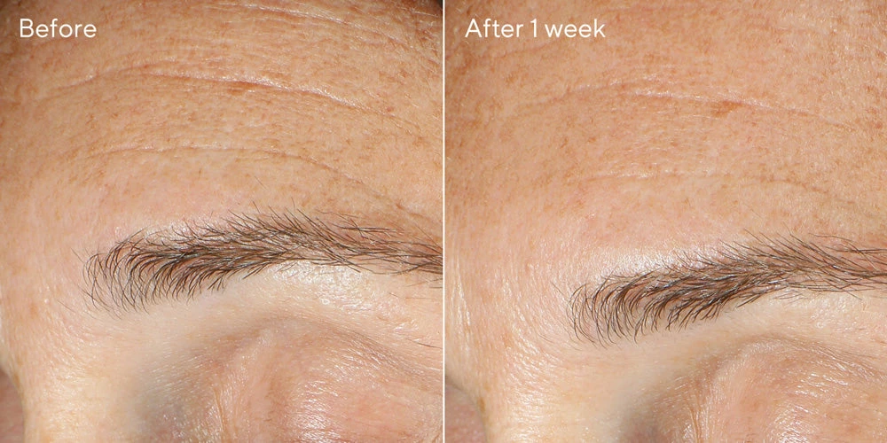 Murad Replenishing Multi-Acid Peel 2 Murad Replenishing Multi-Acid Peel