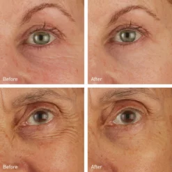 Skincare Skyn Iceland Hydro Cool Firming Eye Gels 8-Pack 5 Skincare Skyn Iceland Hydro Cool Firming Eye Gels 8-Pack