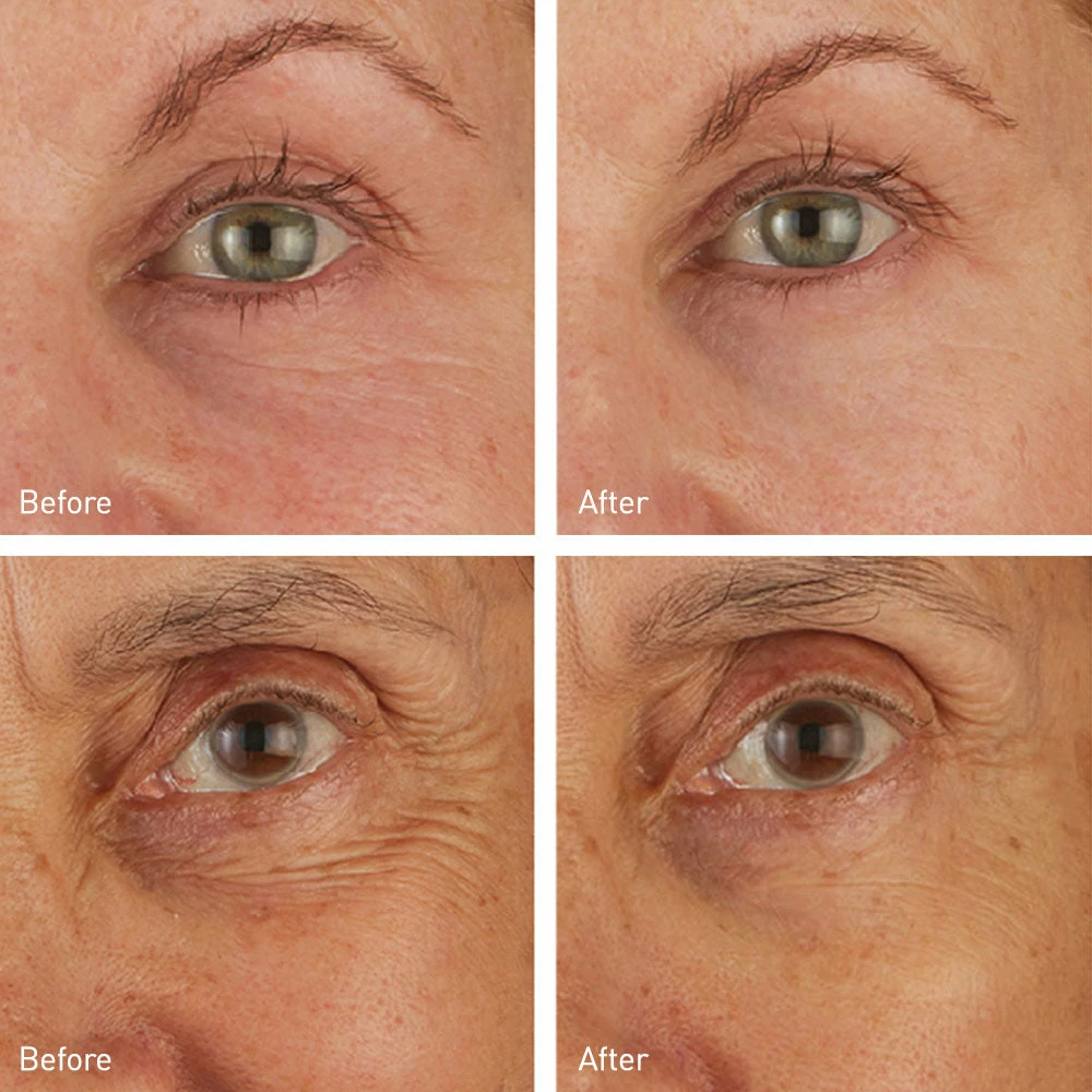 Skincare Skyn Iceland Hydro Cool Firming Eye Gels 8-Pack 3 Skincare Skyn Iceland Hydro Cool Firming Eye Gels 8-Pack