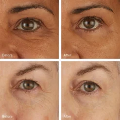 Skincare Skyn Iceland Hydro Cool Firming Eye Gels 8-Pack