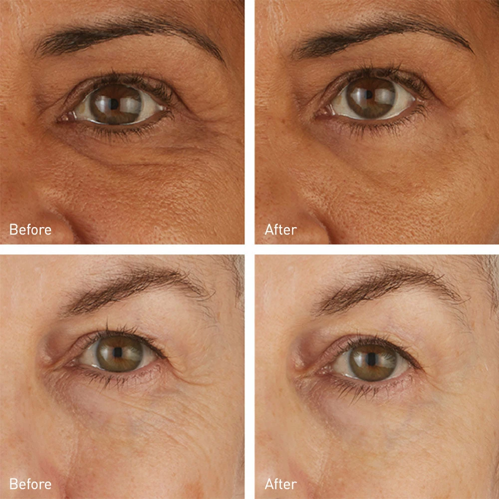 Skincare Skyn Iceland Hydro Cool Firming Eye Gels 8-Pack 2 Skincare Skyn Iceland Hydro Cool Firming Eye Gels 8-Pack